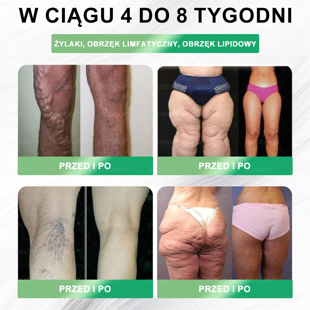 👨⚕DOOEKA® GLP-1 8 w 1 Fit & Vital roztwór doustny🌿 – Raz dziennie, widoczne zmiany w ciągu 7 dni / W przypadku otyłości, zdrowia serca i układu krążenia, cukrzycy, bezdechu sennego, zdrowia jelit, problemów ze stawami i wielu innych