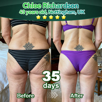 Lotmay® Krople Doustne z Komórkami Macierzystymi i Peptydami Kolagenu 👩‍⚕️ (Ujędrnianie i lifting wiotkiej skóry oraz redukcja powstawania zmarszczek) 🌿