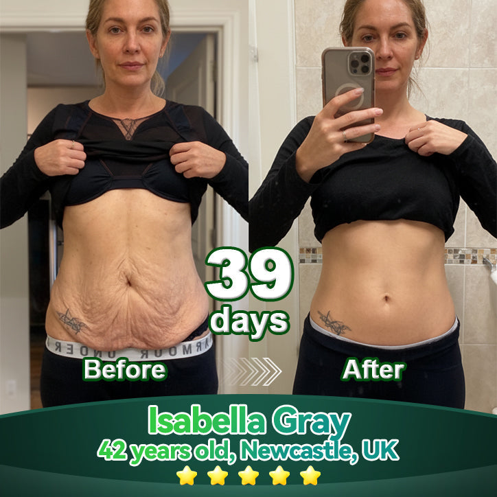 Lotmay® Krople Doustne z Komórkami Macierzystymi i Peptydami Kolagenu 👩‍⚕️ (Ujędrnianie i lifting wiotkiej skóry oraz redukcja powstawania zmarszczek) 🌿