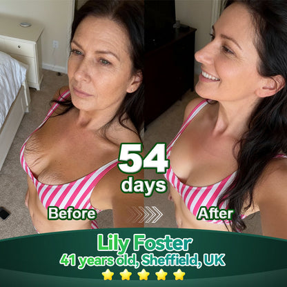 Lotmay® Krople Doustne z Komórkami Macierzystymi i Peptydami Kolagenu 👩‍⚕️ (Ujędrnianie i lifting wiotkiej skóry oraz redukcja powstawania zmarszczek) 🌿