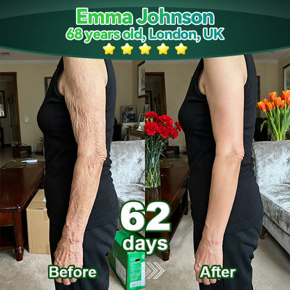 Lotmay® Krople Doustne z Komórkami Macierzystymi i Peptydami Kolagenu 👩‍⚕️ (Ujędrnianie i lifting wiotkiej skóry oraz redukcja powstawania zmarszczek) 🌿